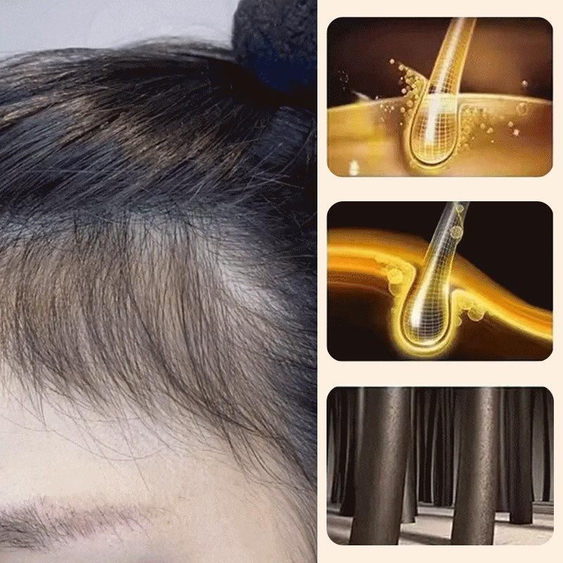 Polygonum Shampoo Cleansing Hair Soap (Pack of 2)